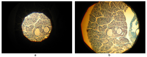
   
    Figure 16 : Vue dans le microscope pour deux réglages différents du diaphragme de champ
   
  